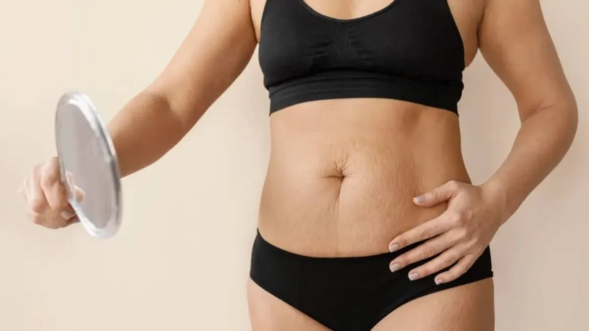 barriga después de embarazo