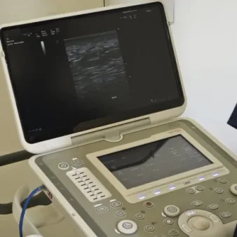 ecografia