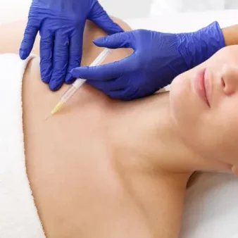 rejuvenecimiento escote