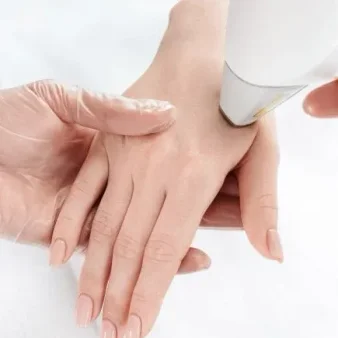 rejuvenecimiento de manos