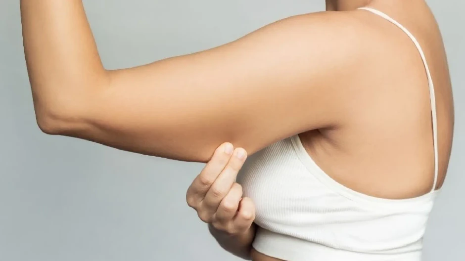 Lifting de brazos con liposucción