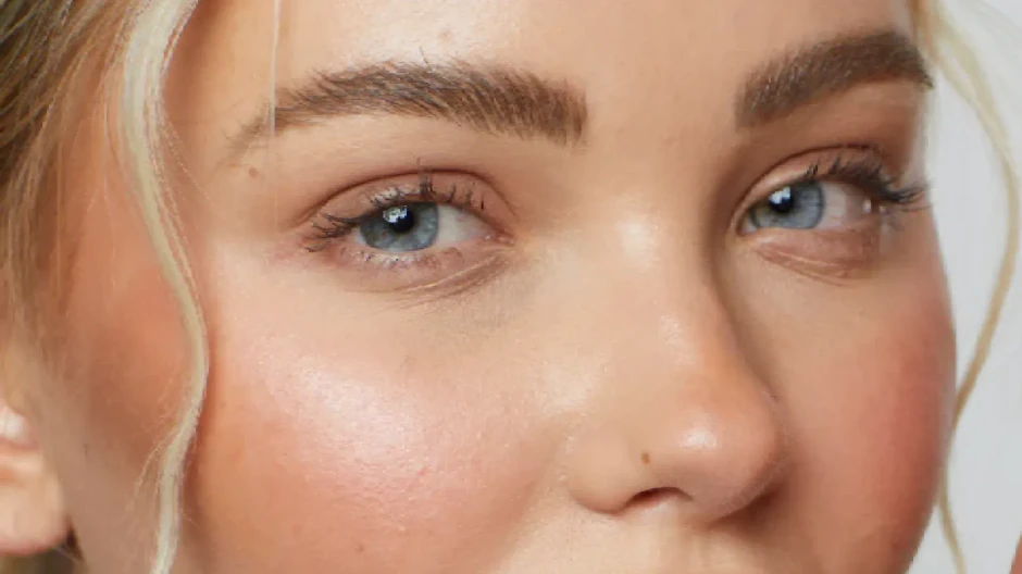 Lifting temporal o lateral